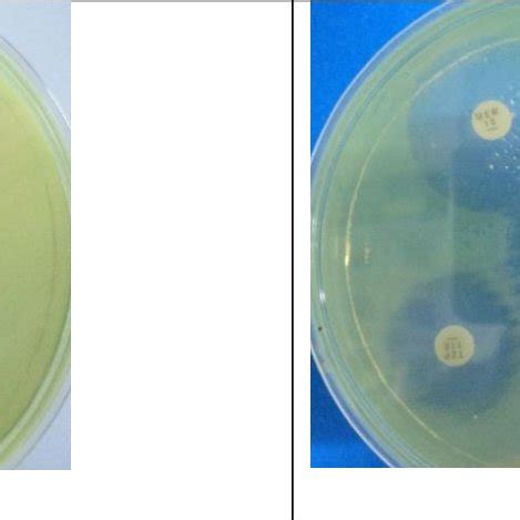Image result for Disk Diffusion Method Procedure