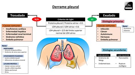 Derrame Pleural: Qué Es, Síntomas Y Tratamiento – SKWMJ