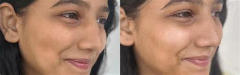 Mineral Sunscreen for Oily, Combination & Sensitive Skin – Oleum Cottage