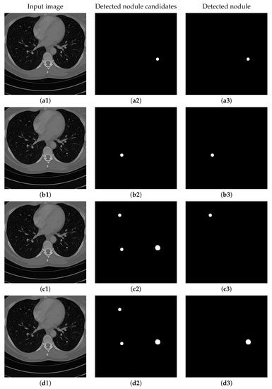 Sensors | Special Issue : Sensors for Biomedical Imaging