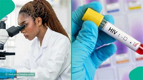 Image result for CMP Lab Report Sample