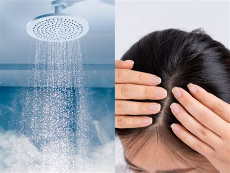 ‘My scalp would bleed after showering and I realized water was causing it!’