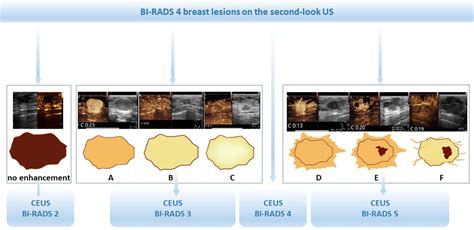 A Prospective Multicenter Study on the Additive Value of Contrast-Enhanced Ultrasound for Biopsy ...