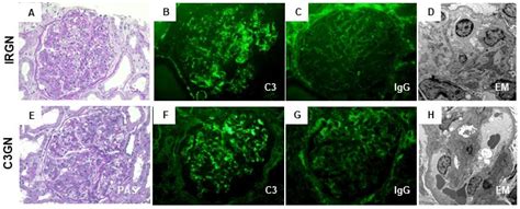 Glomerulonephritis Ultrasound ⏩SOLVED:Match the clinical and ...
