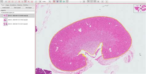 Image result for QuPath Image Analysis