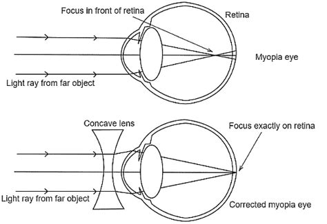 NCERT Exemplar: The Human Eye and the Colourful World - Science Class ...