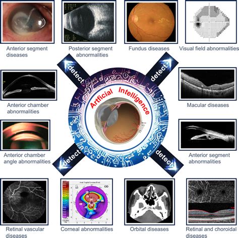 Image result for Eye Diseases Google Engineer Machine Learning