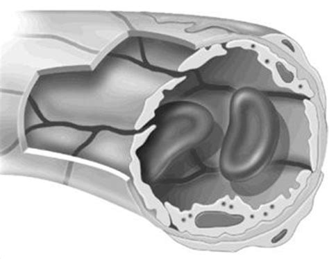 Image result for Capillary Line Type for AutoCAD