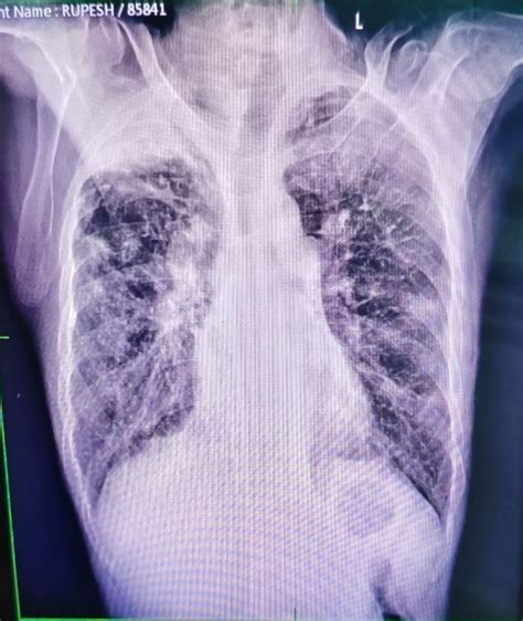 Patient Detail