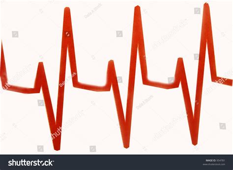 Pulseless Electrical Activity Ecg