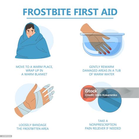 Frostbite Infographic First Aid Instructions Stock Illustration ...
