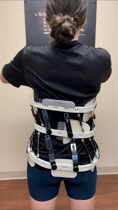 Scoliosis Bracing | Scoliosis Awareness | Westcoast Brace & Limb