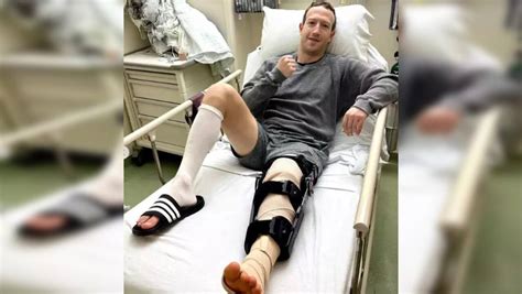 Mark Zuckerberg Undergoes Knee Surgery; Know All About ACL Knee ...
