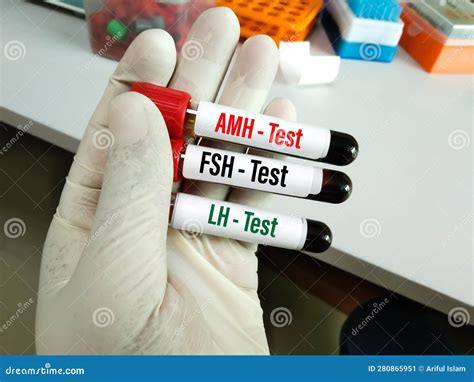 Blood Samples Tube with Sample for AMH, FSH and LH Test. Stock Image - Image of testing, kala ...