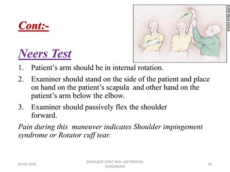 Shoulder Joint - Introduction, Examination,Frozen shoulder #shoulderjoint #jointsof thebody # ...