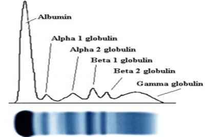 Electrophoresis/Immunofixation Test Service Provider in Pune ...