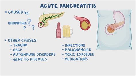 Pancreatitis Causes