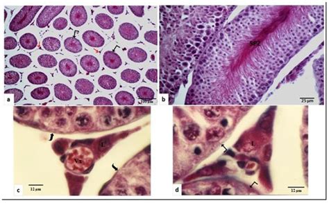 Assessment of Testicular Lhcgr mRNA Expression Correlated with Testis ...