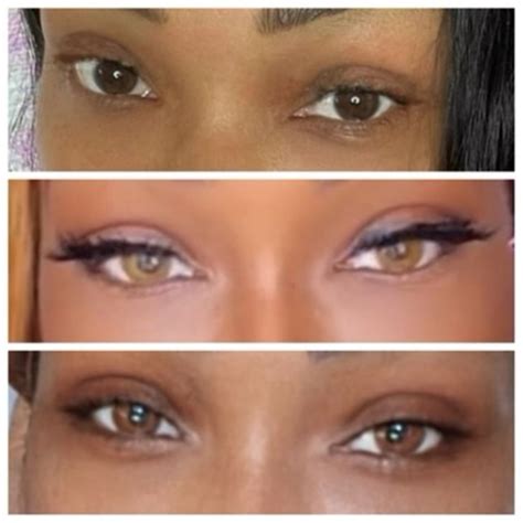 Image result for Eye Color Surgery