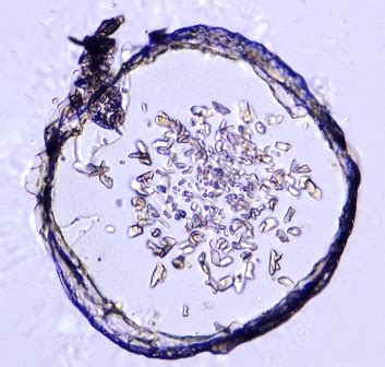 Image result for Lab On-Chip Protein Crystallisation