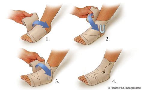 What Do I Do to Treat a Sprained Ankle? | Treating a sprained ankle, Sprained ankle, Sprain