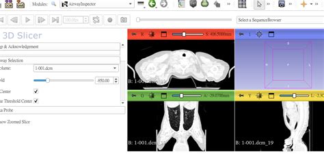 Matplotlib 3D Slice 的图像结果