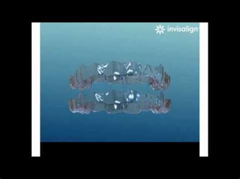 Invisalign Animation 的图像结果