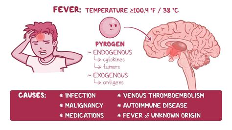 Approach to a fever: Video & Meaning | Osmosis