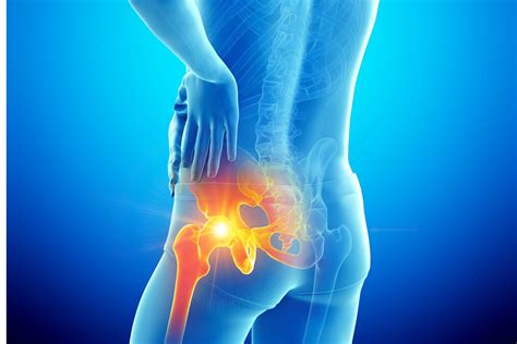 Hip Pain: Causes, Treatment & Prevention - MY MSK Clinic