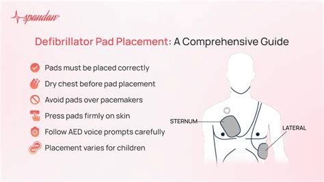 Defibrillator Pad Placement: A Comprehensive Guide
