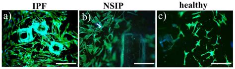Cell-Specific Response of NSIP- and IPF-Derived Fibroblasts to the ...