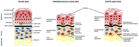 Epigenetic Regulation of Skin Cells in Natural Aging and Premature ...