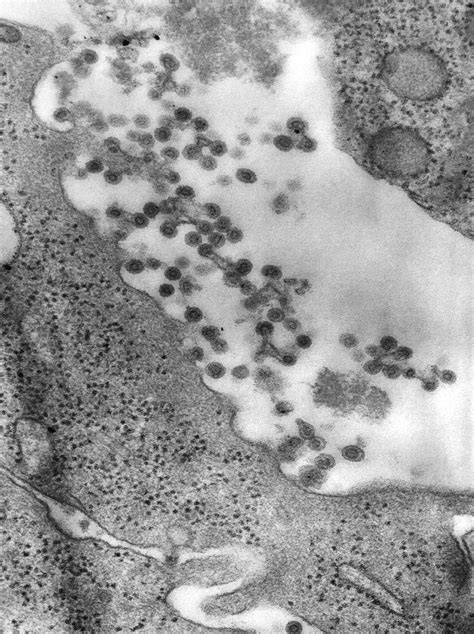 Rubella Virus | Encyclopedia MDPI