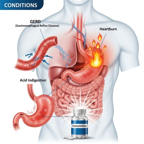 How Famotidine Works: A Simple Guide to Acid Relief