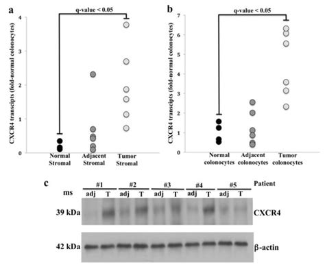 Enhanced CXCR4 Expression Associates with Increased Gene Body 5 ...