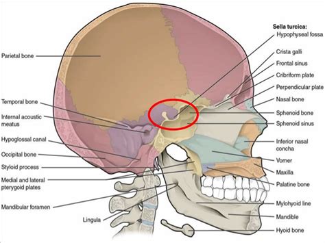 Empty sella syndrome causes, risk factors, symptoms, diagnosis & treatment