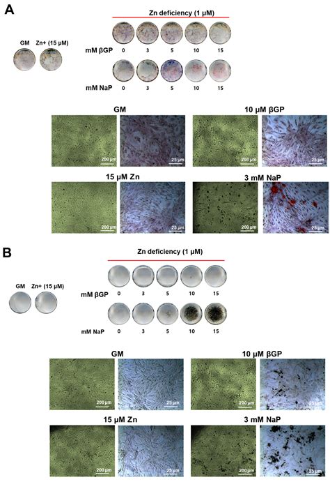 Zinc Deficiency Promotes Calcification in Vascular Smooth Muscle Cells ...