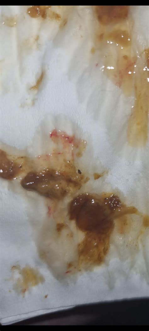 Bloody Mucus Discharge In Newborn Girl at Donald Mccann blog