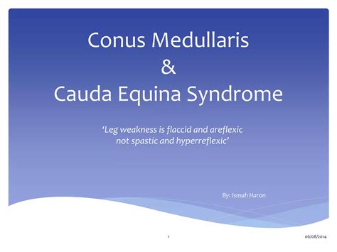 Conus medullaris and cauda equina syndrome | PPTX