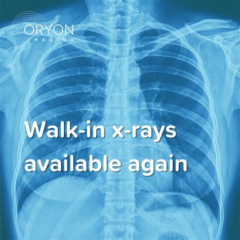 Oryon Imaging on LinkedIn: Walk-in x-rays available again - Oryon