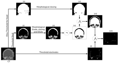 Diagnostics | Special Issue : Brain Imaging in Epilepsy -Volume 2