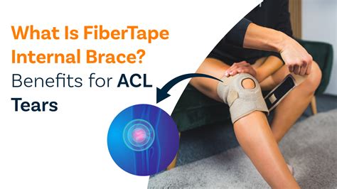 What Is FiberTape Internal Brace? Benefits for ACL Tears