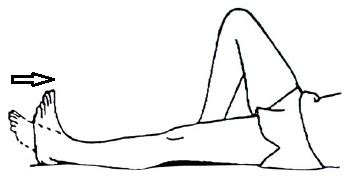 What To Expect After PCL Surgery?