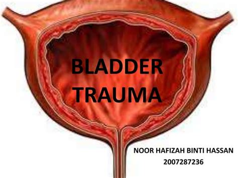 Image result for Bladder Explode