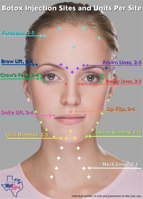 Image result for Botox Forehead Injection Sites Tutorial