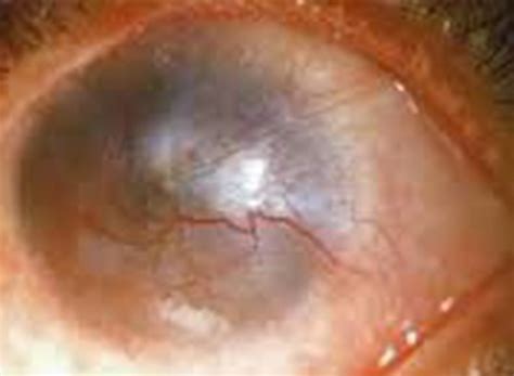 DD Eye Institute - One of the largest premium eye institute in india