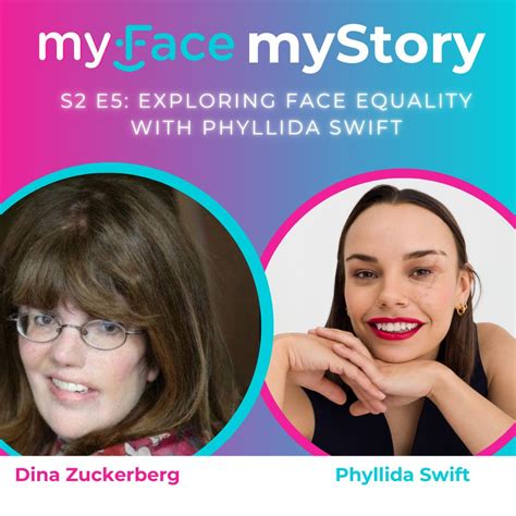 myFace on LinkedIn: #myfacemystory #faceequality #craniofacial # ...