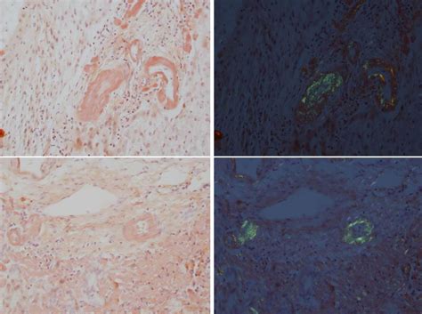 Images of コンゴーレッド - JapaneseClass.jp