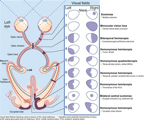 Neurologic Examination In Adult | RECAPEM