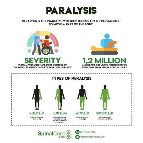Paralysis 的图像结果